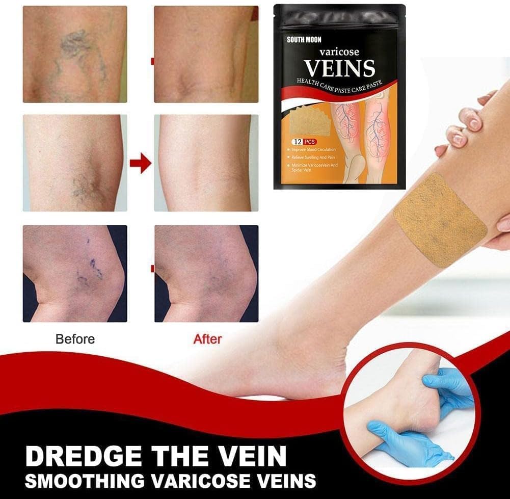 Last Day Of Discount 🔥 Varicose Veins Patch 🩹