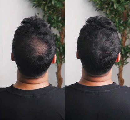 Last Day Of Discount 🔥 Hair Filler Powder | Natural Black