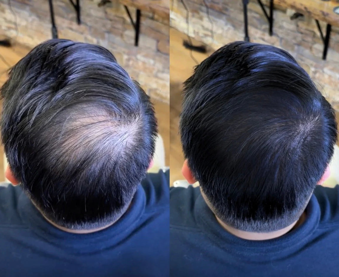 Last Day Of Discount 🔥 Hair Filler Powder | Natural Black