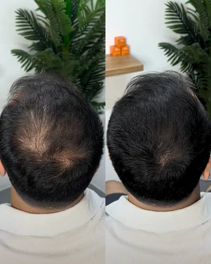 Last Day Of Discount 🔥 Hair Filler Powder | Natural Black