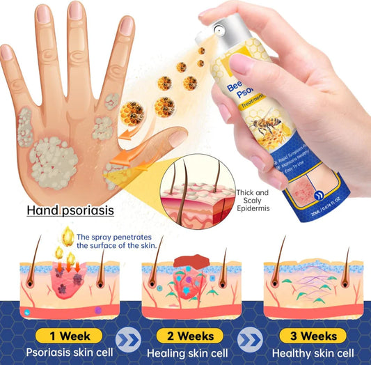 LAST DAY OF DISCOUNT 🔥 BeeVenom Psoriasis Care Spray Pro